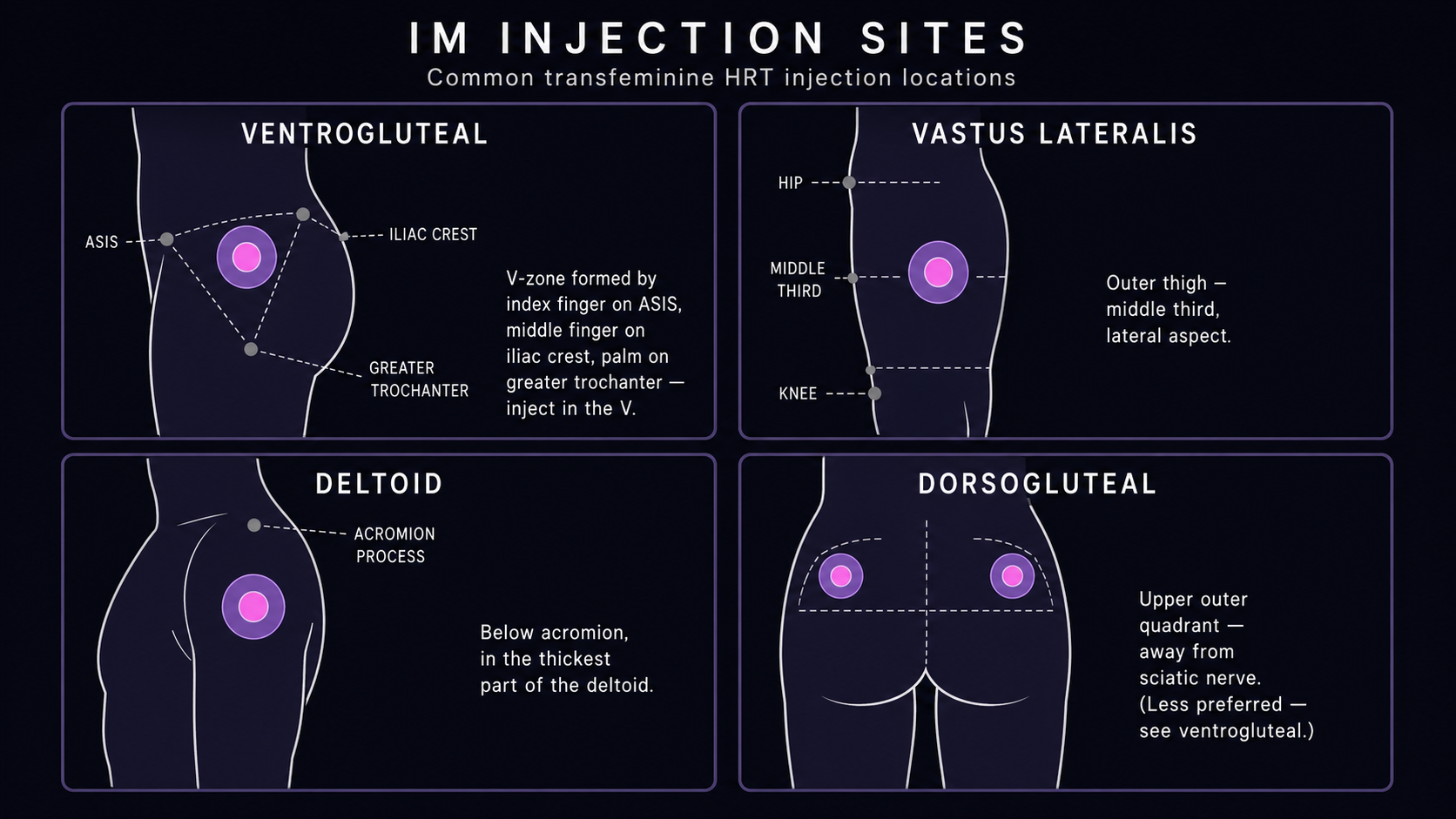 Four-panel reference diagram of common IM injection sites: ventrogluteal (V-zone between ASIS, iliac crest, and greater trochanter), vastus lateralis (outer middle third of thigh), deltoid (below acromion), and dorsogluteal (upper outer quadrant)