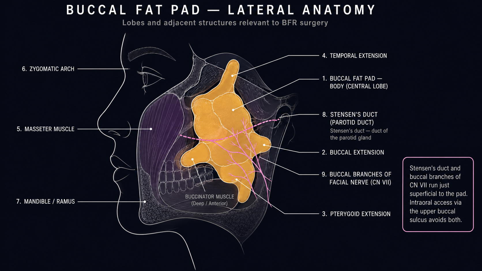 Lateral cutaway of the buccal fat pad showing the central body and buccal, pterygoid, and temporal extensions, with masseter, zygomatic arch, mandible, Stensen's duct, and CN VII buccal branches as references