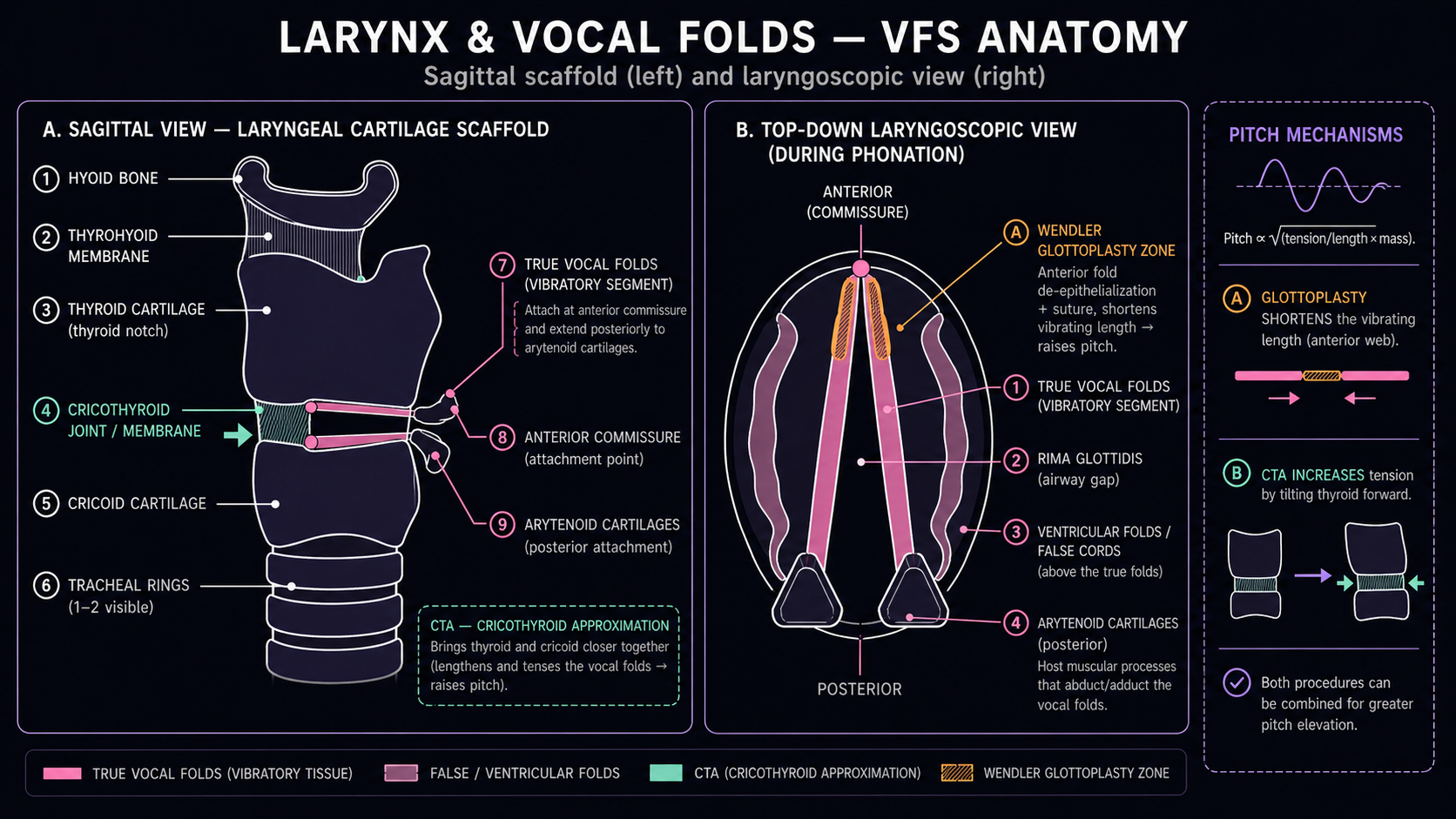 Two-panel larynx anatomy: sagittal scaffold (hyoid, thyrohyoid membrane, thyroid cartilage, cricothyroid joint, cricoid, tracheal rings) with vocal folds attached at anterior commissure plus CTA approximation marker, and top-down laryngoscopic view showing vocal folds meeting at the anterior commissure with arytenoids posterior and Wendler glottoplasty zone on the anterior third